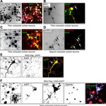 Ankyrin G Antibody in Immunocytochemistry (ICC/IF)