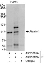 Ataxin-1 Antibody in Immunoprecipitation (IP)