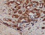 B7-H4 Antibody in Immunohistochemistry (Paraffin) (IHC (P))