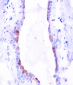 BBOX1 Antibody in Immunohistochemistry (Paraffin) (IHC (P))