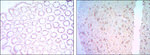 Bcl-2 Antibody in Immunohistochemistry (Paraffin) (IHC (P))