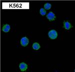 BCR-ABL Antibody in Immunocytochemistry (ICC/IF)