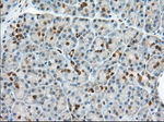 BDH2 Antibody in Immunohistochemistry (Paraffin) (IHC (P))