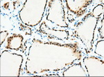 BDH2 Antibody in Immunohistochemistry (Paraffin) (IHC (P))