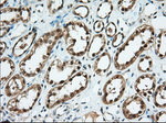 BDH2 Antibody in Immunohistochemistry (Paraffin) (IHC (P))