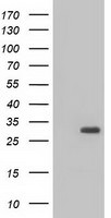 BDH2 Antibody in Western Blot (WB)