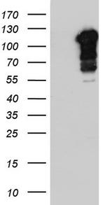 BFSP1 Antibody in Western Blot (WB)