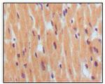 BNP Antibody in Immunohistochemistry (Paraffin) (IHC (P))