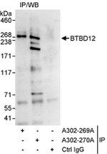 BTBD12 Antibody in Immunoprecipitation (IP)