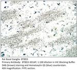 BTBD3 Antibody in Immunohistochemistry (IHC)