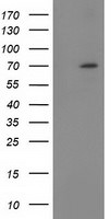 BTRC Antibody in Western Blot (WB)