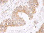 Bcl-2 Antibody in Immunohistochemistry (IHC)