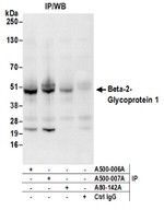 Beta-2-Glycoprotein 1 Antibody in Western Blot (WB)