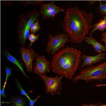 beta Tubulin Loading Control Antibody in Immunocytochemistry (ICC/IF)