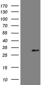 C19ORF80 Antibody in Western Blot (WB)