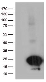 C20orf79 Antibody in Western Blot (WB)