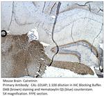 Calretinin Antibody in Immunohistochemistry (IHC)