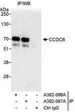 CCDC6 Antibody in Immunoprecipitation (IP)