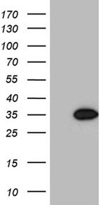 CCND1 Antibody in Western Blot (WB)