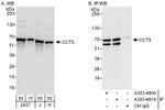 CCT5 Antibody in Western Blot (WB)