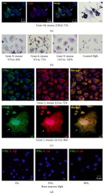 CD11b Antibody in Immunocytochemistry (ICC/IF)