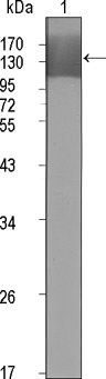 VEGF Receptor 2 Antibody in Western Blot (WB)