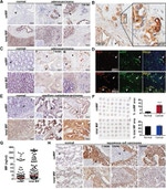 CD31 (PECAM-1) Antibody in Immunohistochemistry (IHC)