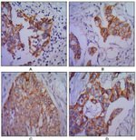 N-cadherin Antibody in Immunohistochemistry (Paraffin) (IHC (P))