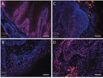 CD34 Antibody in Immunohistochemistry (IHC)