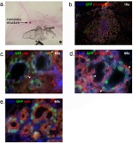 CD61 (Integrin beta 3) Antibody in Immunohistochemistry (IHC)