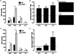 CD4 Antibody in Immunohistochemistry (IHC)