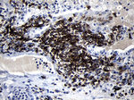 CD79B Antibody in Immunohistochemistry (Paraffin) (IHC (P))