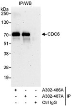 CDC6 Antibody in Immunoprecipitation (IP)