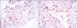 CDK1 Antibody in Immunohistochemistry (Paraffin) (IHC (P))