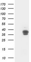 CDK2 Antibody in Western Blot (WB)