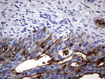 CEA (CEACAM5) Antibody in Immunohistochemistry (Paraffin) (IHC (P))