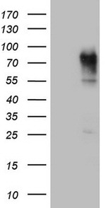 CEA (CEACAM5) Antibody in Western Blot (WB)