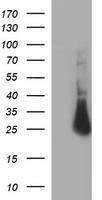 CHAC1 Antibody in Western Blot (WB)