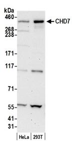 CHD7 Antibody in Western Blot (WB)