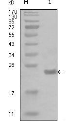 IKK alpha Antibody in Western Blot (WB)