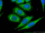 COTL1 Antibody in Immunocytochemistry (ICC/IF)