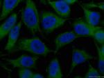 VCP Antibody in Immunocytochemistry (ICC/IF)