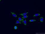 RPL3 Antibody in Immunocytochemistry (ICC/IF)