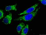 ATP5O Antibody in Immunocytochemistry (ICC/IF)