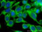 ASK1 Antibody in Immunocytochemistry (ICC/IF)