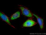 S100A11 Antibody in Immunocytochemistry (ICC/IF)