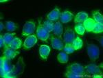 Cytokeratin 20 Antibody in Immunocytochemistry (ICC/IF)