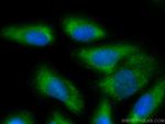 Galectin-1 Antibody in Immunocytochemistry (ICC/IF)