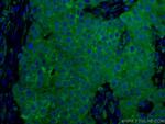 CD9 Antibody in Immunohistochemistry (Paraffin) (IHC (P))