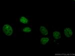 TBP Antibody in Immunocytochemistry (ICC/IF)